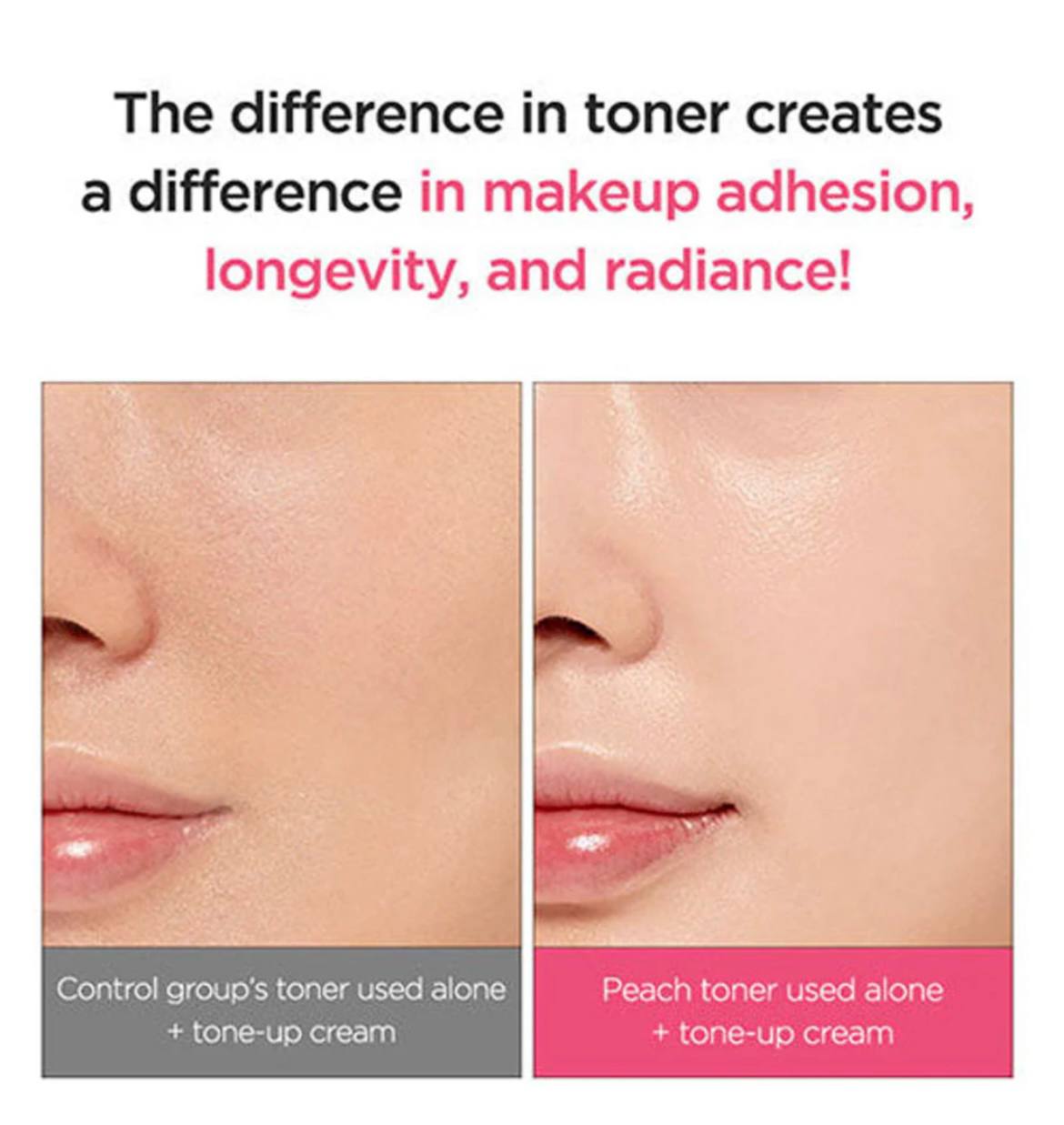 تونر اسنس هلو و نیاسینامید آنوا - Image 4