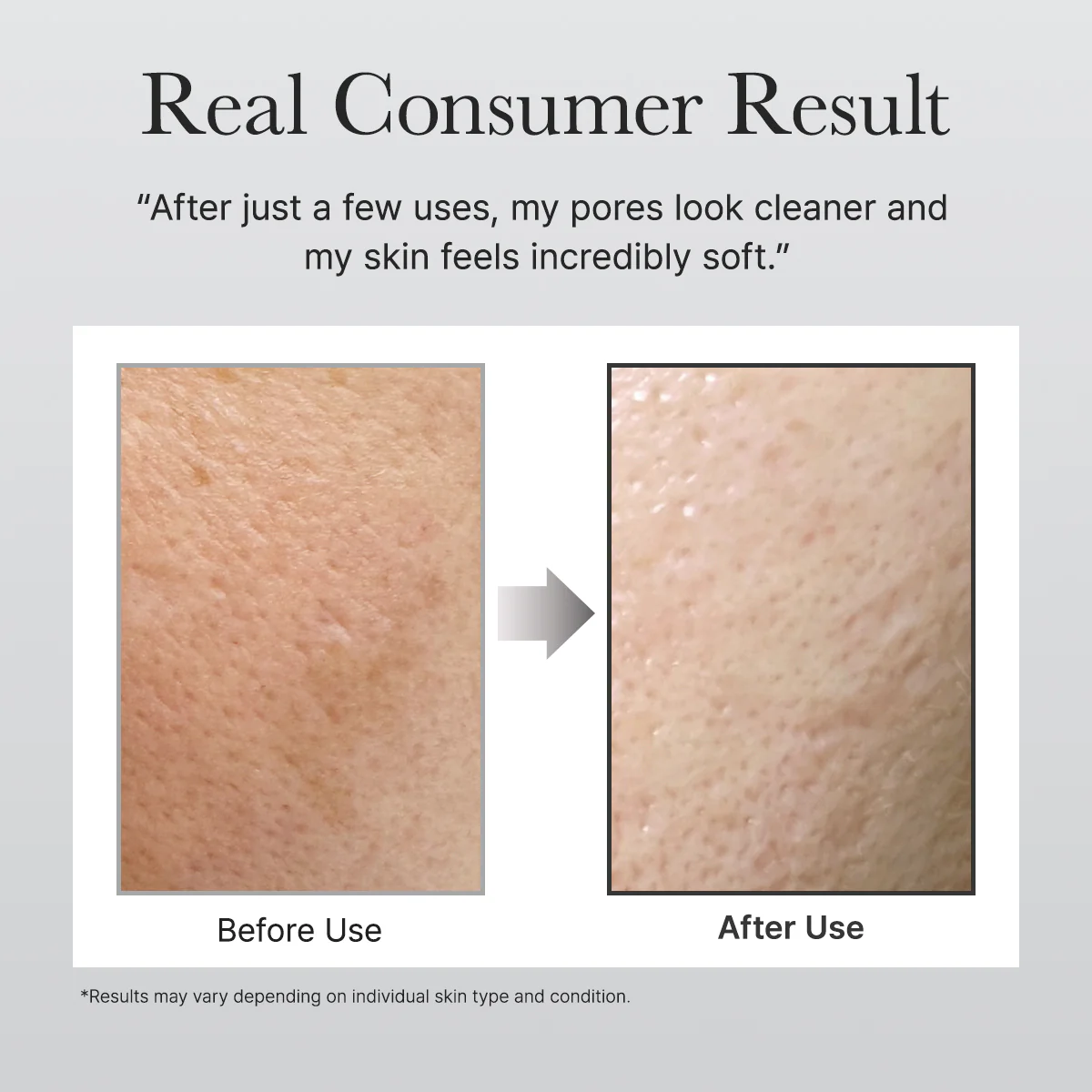 ژل شستشوی موچی برنج و چای سیاه آرنسیا - Image 5