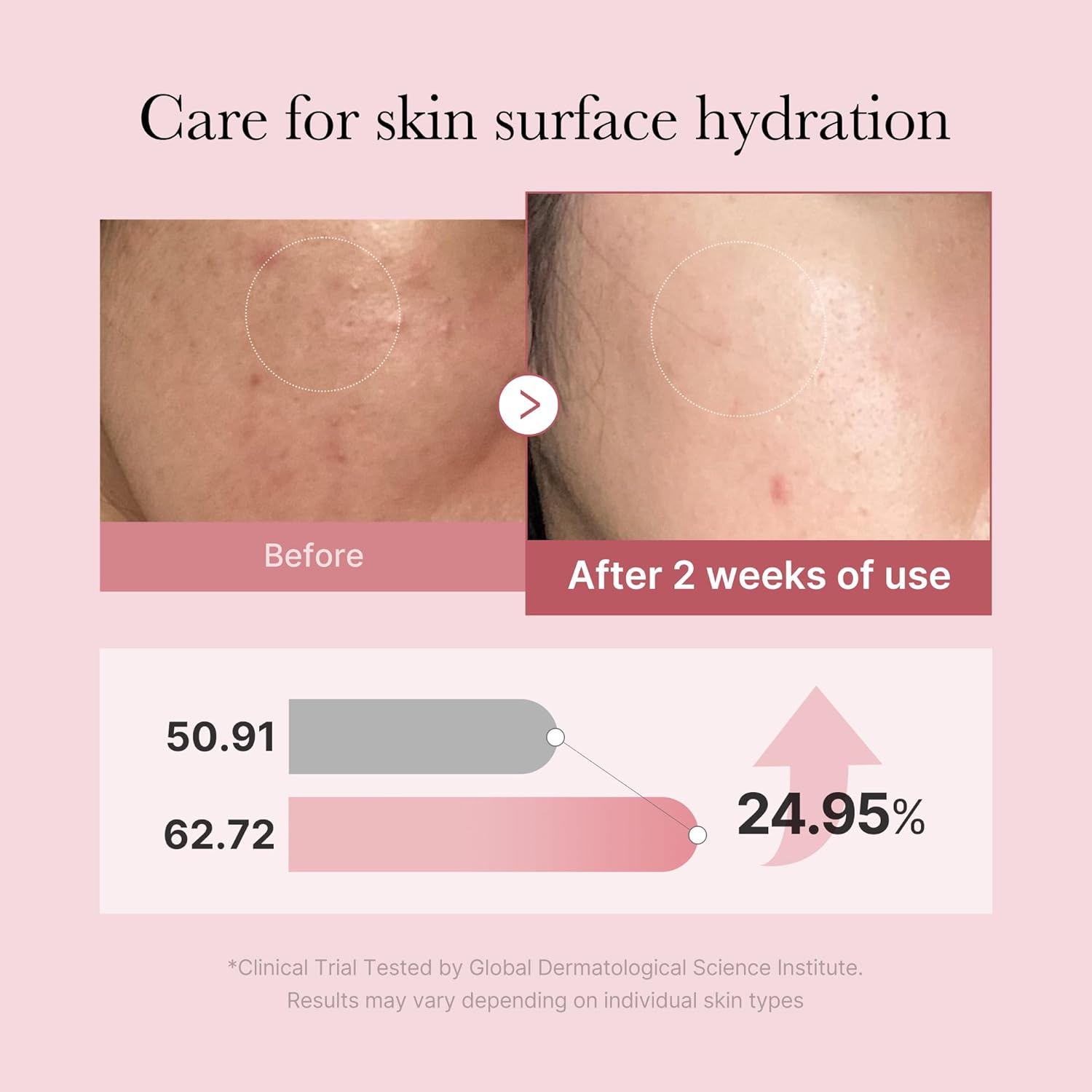 میست سرم گلوتاتیون صورتی PDRN مدیکیوب - Image 2