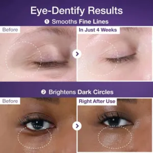 دورچشم NAD+ و رتینول نامبوزین
