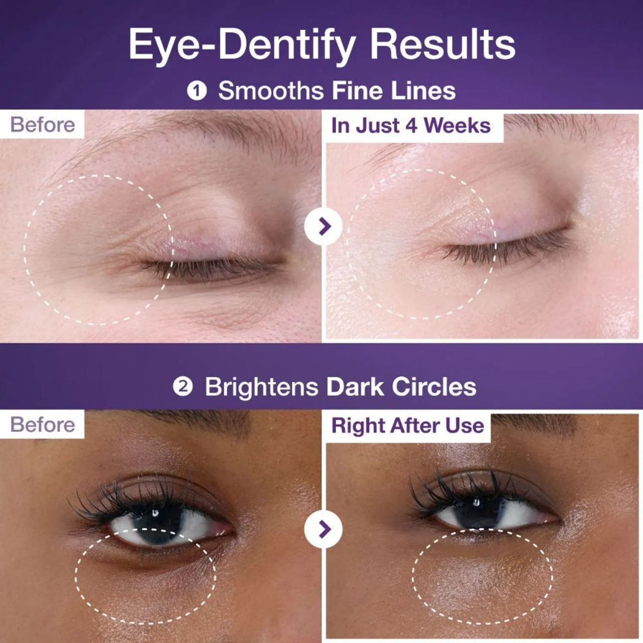 دورچشم NAD+ و رتینول نامبوزین - Image 3