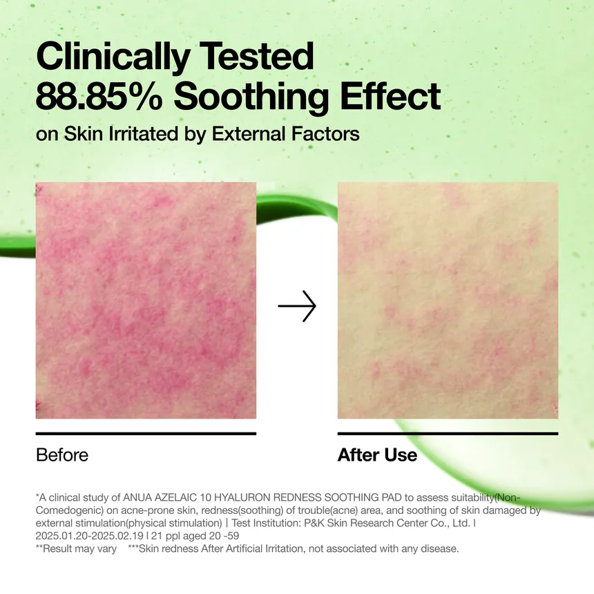 تونر پد آزلائیک اسید و هیالورون آنوا - Image 6