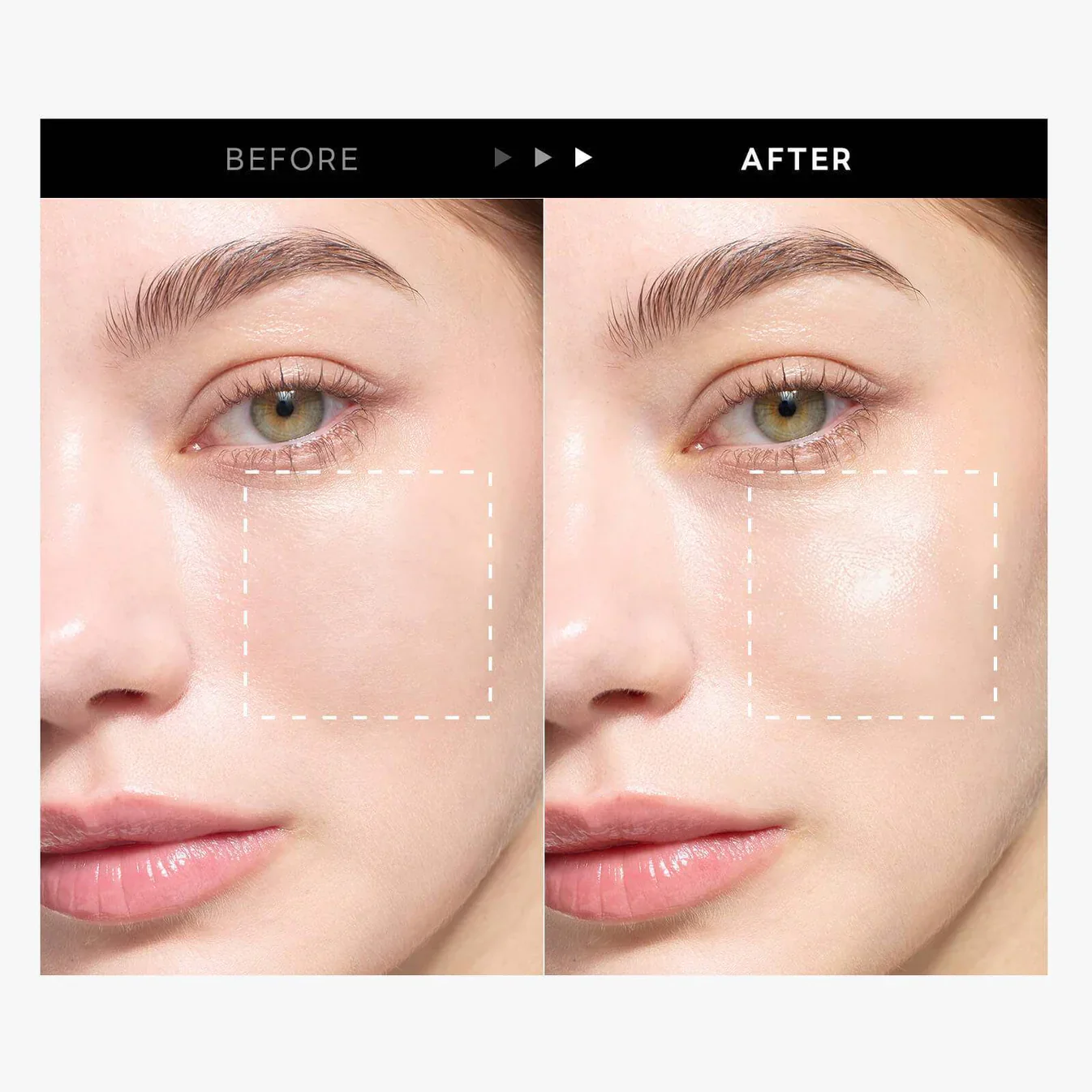 پک ضدآفتاب سه عددی راندلب - Image 2