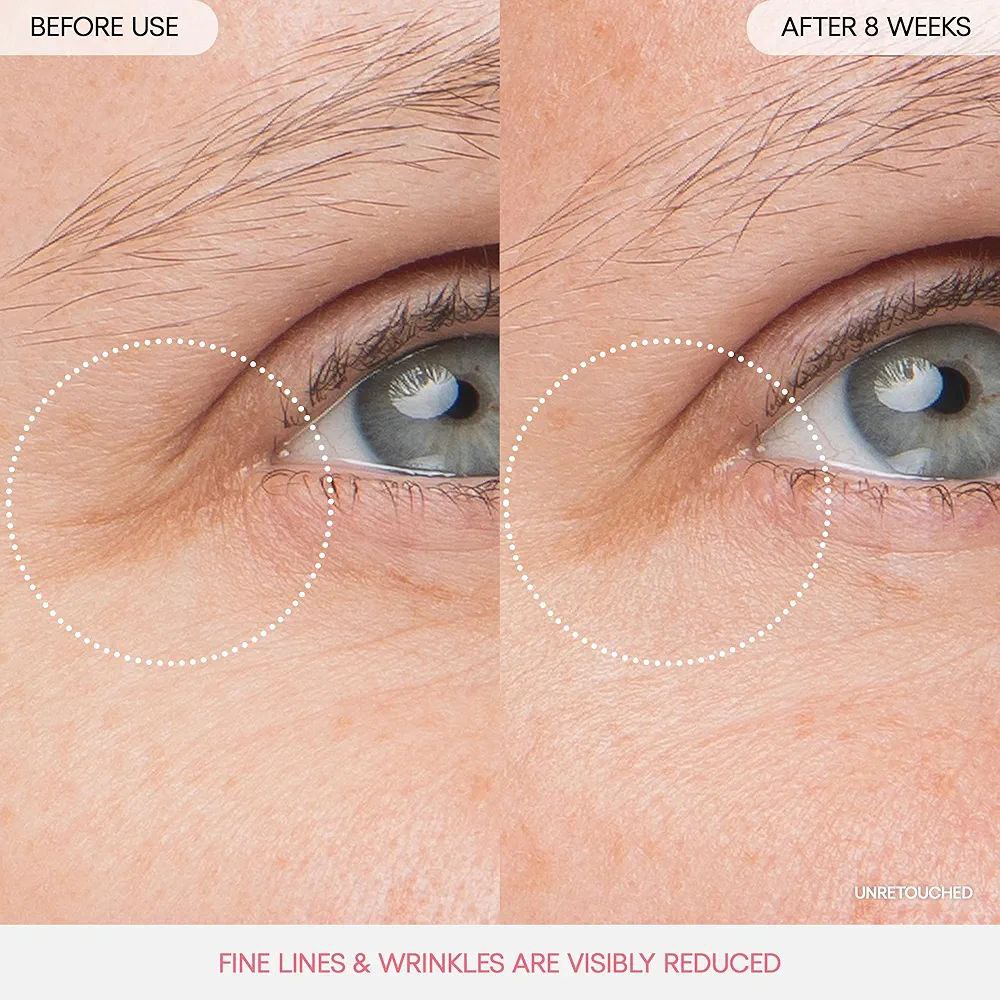 ست آبرسان، دور چشم و ماسک لب لانیژ - Image 5